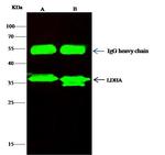 LDHA Antibody in Immunoprecipitation (IP)