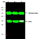 LDHA Antibody in Immunoprecipitation (IP)