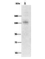 Leptin Receptor Antibody in Western Blot (WB)