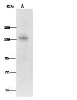 Leptin Receptor Antibody in Western Blot (WB)