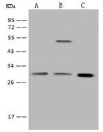 Galectin 3 Antibody in Western Blot (WB)