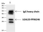 Galectin 3 Antibody in Immunoprecipitation (IP)