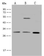 Galectin 3 Antibody in Western Blot (WB)