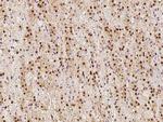 LTA4H Antibody in Immunohistochemistry (Paraffin) (IHC (P))