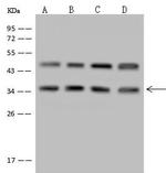 LZTFL1 Antibody in Western Blot (WB)