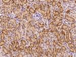 MEK3 Antibody in Immunohistochemistry (Paraffin) (IHC (P))