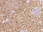 MEK3 Antibody in Immunohistochemistry (Paraffin) (IHC (P))