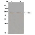 MBD4 Antibody in Immunoprecipitation (IP)