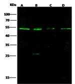 MBD4 Antibody in Western Blot (WB)