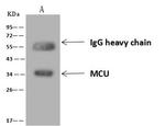 MCU Antibody in Immunoprecipitation (IP)