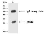 MIS12 Antibody in Immunoprecipitation (IP)