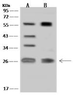 MIS12 Antibody in Western Blot (WB)