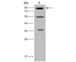 MLPH Antibody in Western Blot (WB)