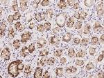 MLPH Antibody in Immunohistochemistry (Paraffin) (IHC (P))