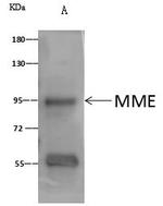 CD10 Antibody in Immunoprecipitation (IP)