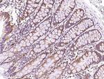 MUT Antibody in Immunohistochemistry (Paraffin) (IHC (P))