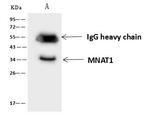 MNAT1 Antibody in Immunoprecipitation (IP)