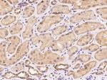 MRPL11 Antibody in Immunohistochemistry (Paraffin) (IHC (P))