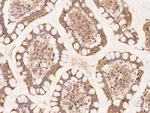 MRPL11 Antibody in Immunohistochemistry (Paraffin) (IHC (P))