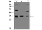 MRPL15 Antibody in Western Blot (WB)