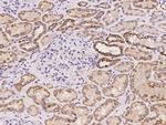 MRPS23 Antibody in Immunohistochemistry (Paraffin) (IHC (P))