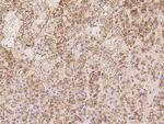 MRPS23 Antibody in Immunohistochemistry (Paraffin) (IHC (P))