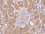 MTRR Antibody in Immunohistochemistry (Paraffin) (IHC (P))