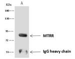 MTRR Antibody in Immunoprecipitation (IP)