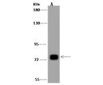 MTRR Antibody in Western Blot (WB)