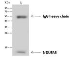 NDUFA5 Antibody in Immunoprecipitation (IP)