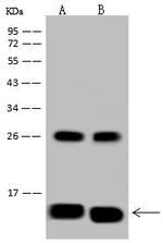 NDUFA5 Antibody in Western Blot (WB)