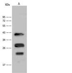 Nkx3.1 Antibody in Western Blot (WB)