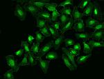 NOTCH2 Antibody in Immunocytochemistry (ICC/IF)