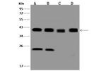 NPM1 Antibody in Western Blot (WB)