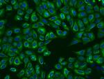 P4HA2 Antibody in Immunocytochemistry (ICC/IF)