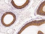 P4HA2 Antibody in Immunohistochemistry (Paraffin) (IHC (P))