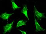 PAK1 Antibody in Immunocytochemistry (ICC/IF)