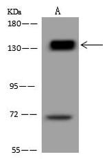 Palladin Antibody in Western Blot (WB)