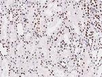 PAX2 Antibody in Immunohistochemistry (Paraffin) (IHC (P))