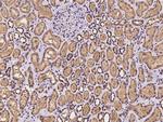 Alix Antibody in Immunohistochemistry (Paraffin) (IHC (P))