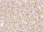 PDSS2 Antibody in Immunohistochemistry (Paraffin) (IHC (P))