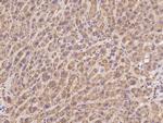 PDSS2 Antibody in Immunohistochemistry (Paraffin) (IHC (P))