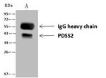 PDSS2 Antibody in Immunoprecipitation (IP)