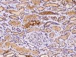 PKD2 Antibody in Immunohistochemistry (Paraffin) (IHC (P))