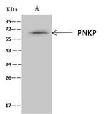 PNK Antibody in Immunoprecipitation (IP)