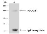 POLR2B Antibody in Immunoprecipitation (IP)