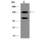 POLR2B Antibody in Western Blot (WB)