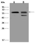 PPAT Antibody in Western Blot (WB)