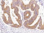 PPM1A Antibody in Immunohistochemistry (Paraffin) (IHC (P))