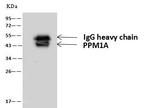 PPM1A Antibody in Immunoprecipitation (IP)